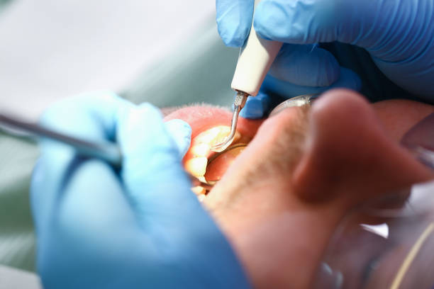 Best Knocked-Out Tooth Emergency  in Knightdale, NC