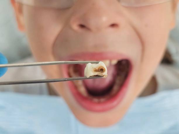 Best Tooth Infection Emergency Dentist  in Knightdale, NC