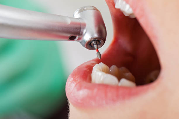 Tooth Infection Emergency Dentist in NC